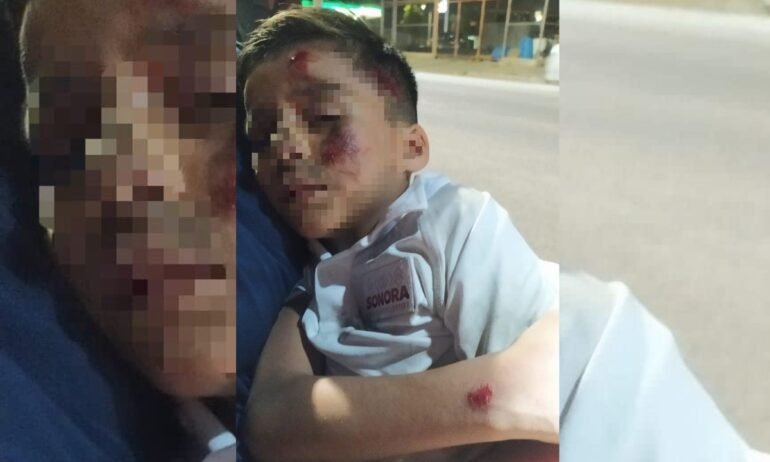 Atropellan a niño de 6 años y conductor se da a la fuga al norte de Hermosillo